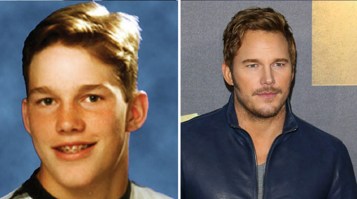 10 Celebrities who were the Nerds of their class and now are the most sought after galleries in the world 17 Celebrities who were the Nerds of their class and now are the most sought after galleries in the world