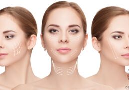 Everything you need to know about neck lift