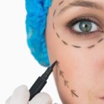 plastic surgery malpractice