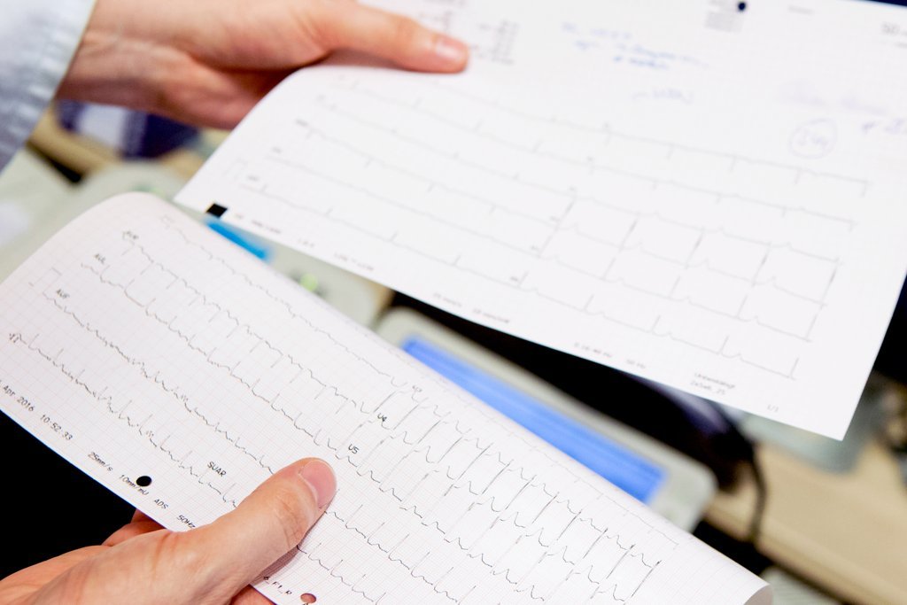 Heart failure patients are at higher risk of developing cancer