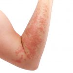 SKIN 1