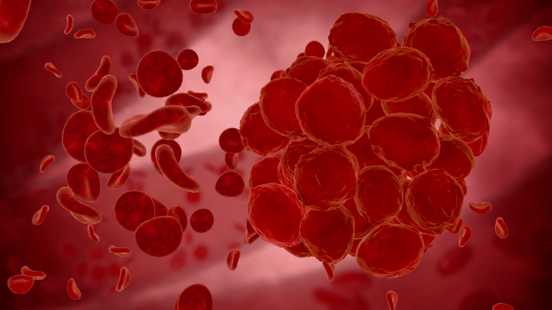 World Thrombosis Day: Why Blood Clots Are An Urgent Global Public Health Problem World Thrombosis Day: Why Blood Clots Are An Urgent Global Public Health Problem