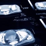 Cambridge Incredible Minds Are Transforming the Lives of Breast and Prostate Cancer Patients C 1