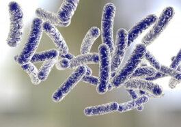 Legionella pneumophilia