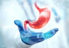 3 answers to your questions about gastric bypass