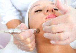 732x549 THUMBNAIL Microdermabrasion 1 732x549 1