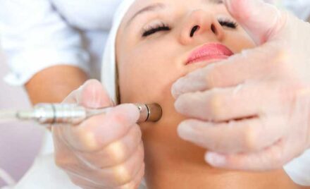 732x549 THUMBNAIL Microdermabrasion 1 732x549 1