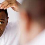 Alopecia and nutrition