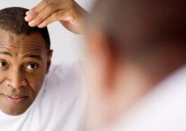 Alopecia and nutrition