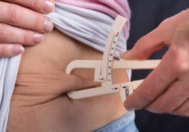 Bariatric surgery is perfect for patients with obesity and years on diet