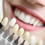 DENTAL COLOR EVERYTHING WE NEED TO KNOW AND ITS RELATIONSHIP WITH DENTAL AESTHETICS