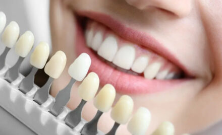 DENTAL COLOR EVERYTHING WE NEED TO KNOW AND ITS RELATIONSHIP WITH DENTAL AESTHETICS