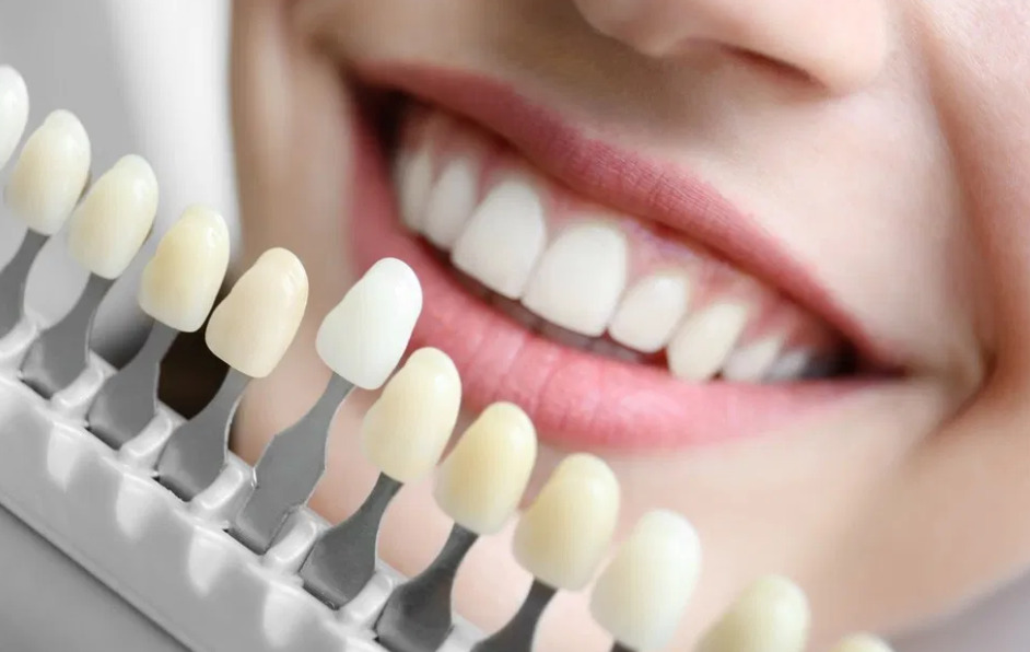 DENTAL COLOR EVERYTHING WE NEED TO KNOW AND ITS RELATIONSHIP WITH DENTAL AESTHETICS