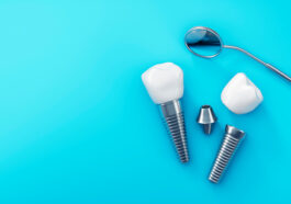 Dental implants 2