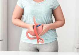 Gastric Bypass diatetic guidelines in the postoperative period