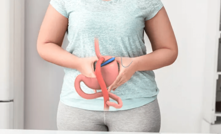 Gastric Bypass diatetic guidelines in the postoperative period