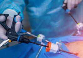 Metabolic surgery what is it