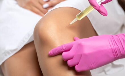 Platelet Rich Plasma