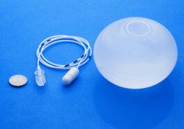 The Elipse Balloon A new gastric Balloon with Interesting Features