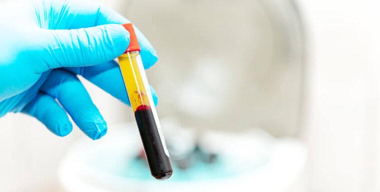 What is Platelet Rich Plasma PRP