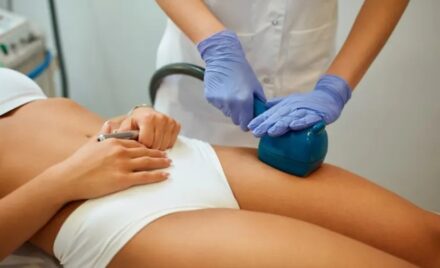 anti cellulite treatments