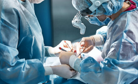 buccinoplasty