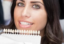 dental veneers 2 1920w