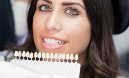 dental veneers 2 1920w