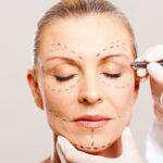 facial rejuvenation