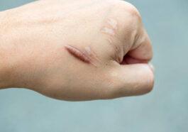 istockphoto 1168150293 612x612 1