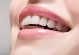 istockphoto 74409357 612x612 1