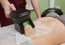 lipolysis a cryolipolysis and a hydrolipoclasia