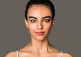 portrait woman with problematic skin with acne half face with make up