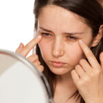 Dark Circles Removal Causes, Treatments, Cost, Results & FAQ's dark circles