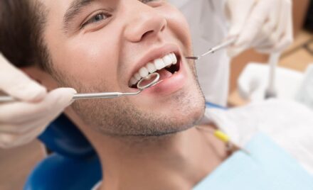 dental implants
