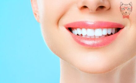 Teeth whitening
