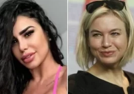 lis vega rostro botox