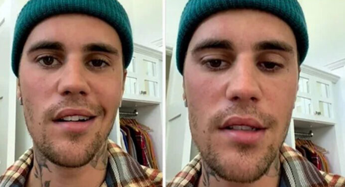 Justin Bieber spoke about the disease that paralyzed his face