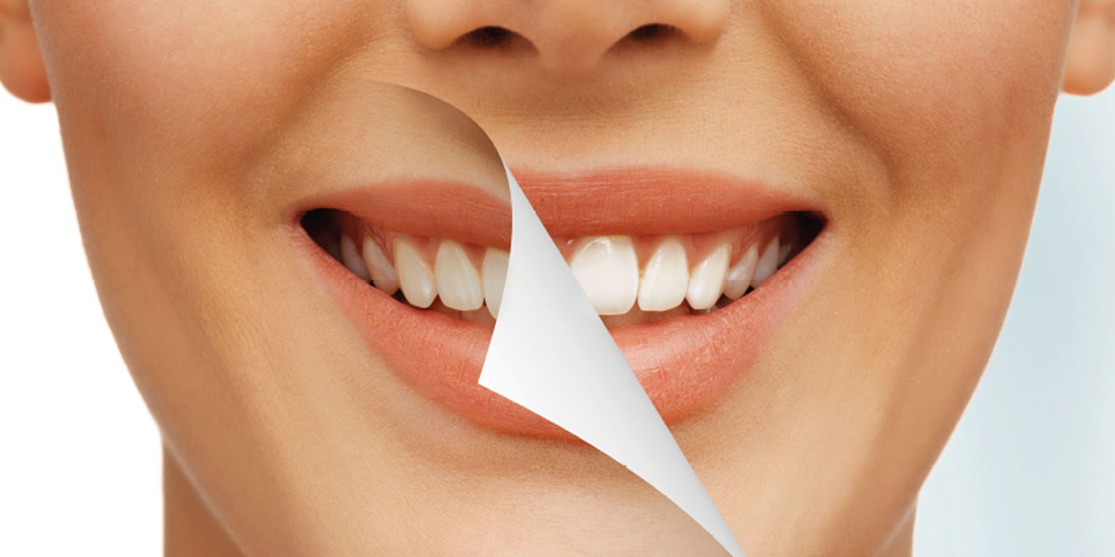 What are the best teeth whitening techniques? teeth whitening
