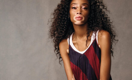 Who is Winnie Harlow