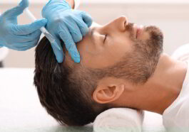 ALOPECIA AREATA TREATMENT