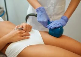 cellulite treatment