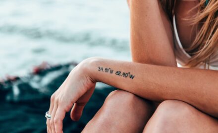 tattoo removal
