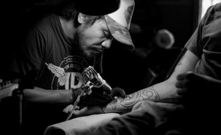tattoo removal